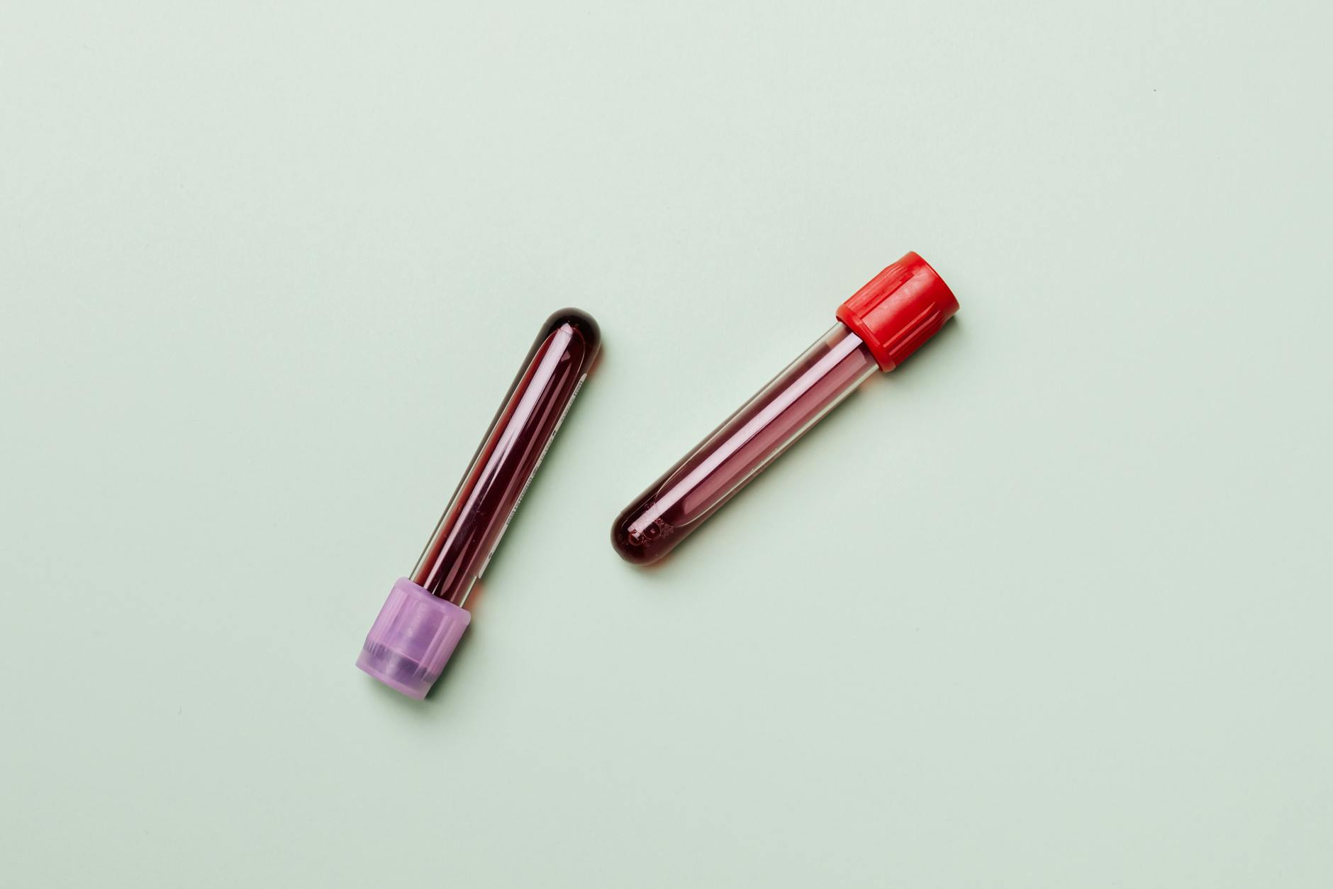 What I Learned From Genetic Testing